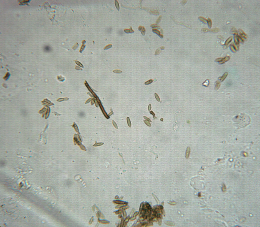 Venturia asperata : conidies (au microscope)